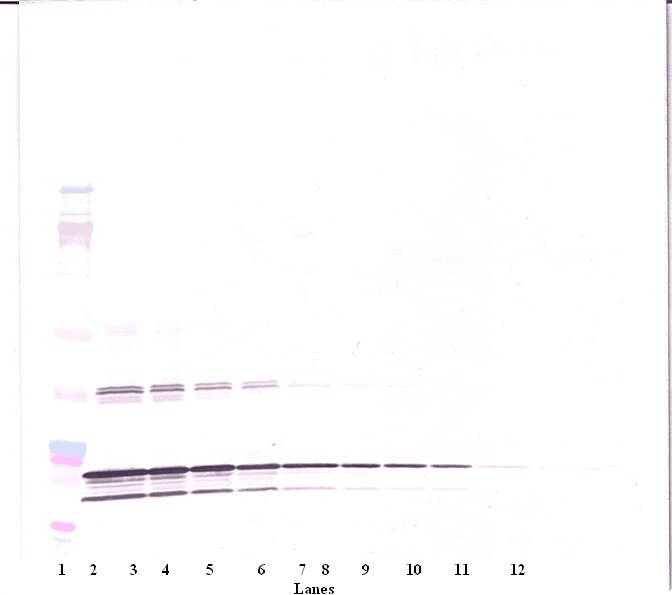 Polyclonal Rabbit anti-Human LTA / TNF Beta Antibody (WB)