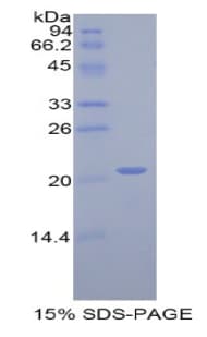 Rat ARPC4 Protein (Recombinant His)