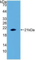 Human IL-1B / IL-1 Beta Protein (Recombinant His, N-Terminal)