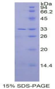 Human IL31RA Protein (Recombinant 6His, N-terminus)
