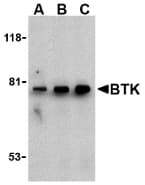 BTK Antibody