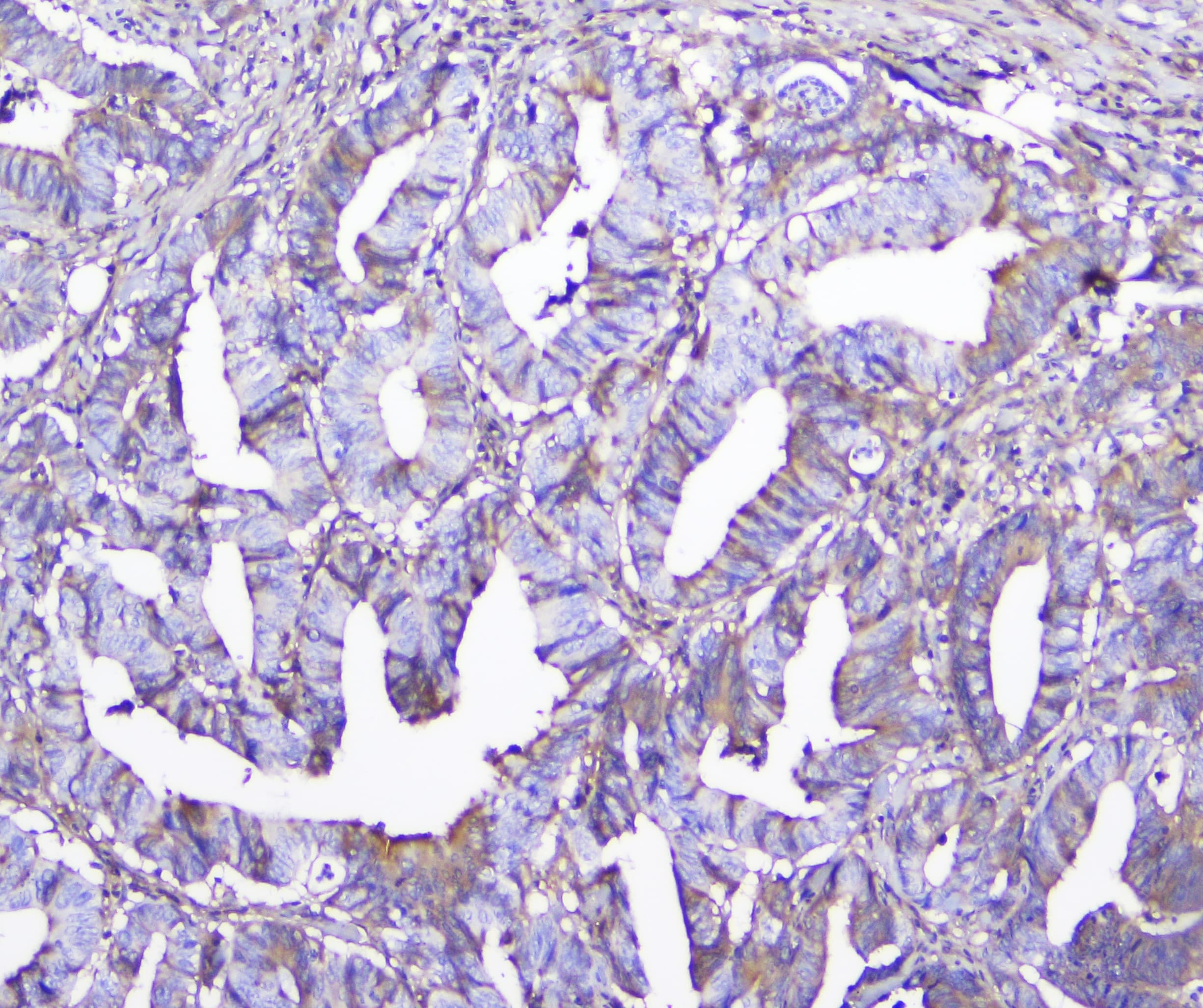 GSTM1 Antibody