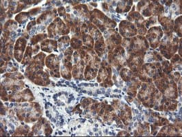 Monoclonal Mouse anti-Human RGS16 Antibody (clone OTI4F9, IHC, WB)