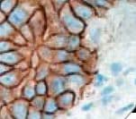 CTNNB1 / Beta Catenin Antibody (clone 14, Ready-to-Use)