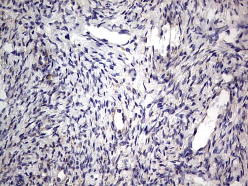 PRX-1 / PRRX1 Antibody (clone OTI1E10)