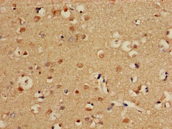 CPT1C Antibody