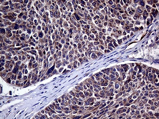 Monoclonal Mouse anti-Human HABP2 Antibody (clone OTI5H3, aa33-330, IHC, WB)