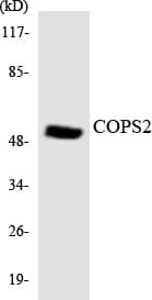 Polyclonal Rabbit anti-Human COPS2 / TRIP15 / ALIEN Antibody (aa158-207, WB)