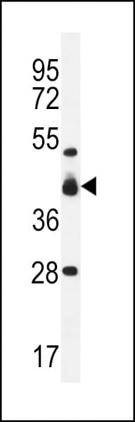 Polyclonal Rabbit anti-Human VSIG8 Antibody (aa331-360, IHC, WB)