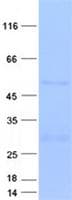 Human FSTL3 / FLRG Protein (Recombinant GST, N-terminus + His, C-terminus)