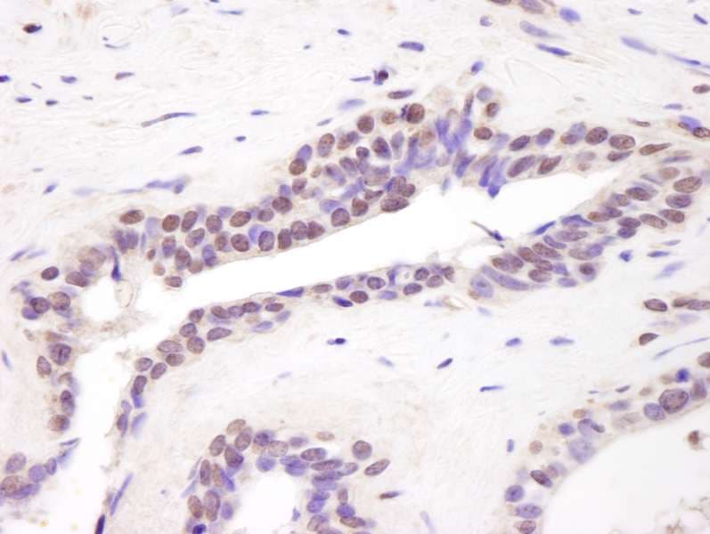 Polyclonal Rabbit anti-Human BRD8 Antibody (aa25-75 in Uniprot entry Q9H0E9.2), IHC, WB)