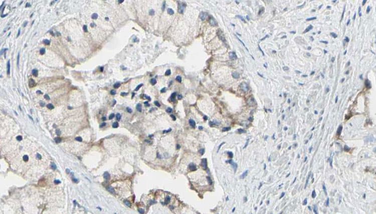TRIM29 Antibody