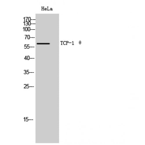 CCT8 Antibody (330-410 aa, Internal)