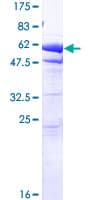 Human EEF1D Protein (Recombinant GST)