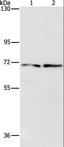 Polyclonal Rabbit anti-Human IFT74 / CCDC2 Antibody (WB)