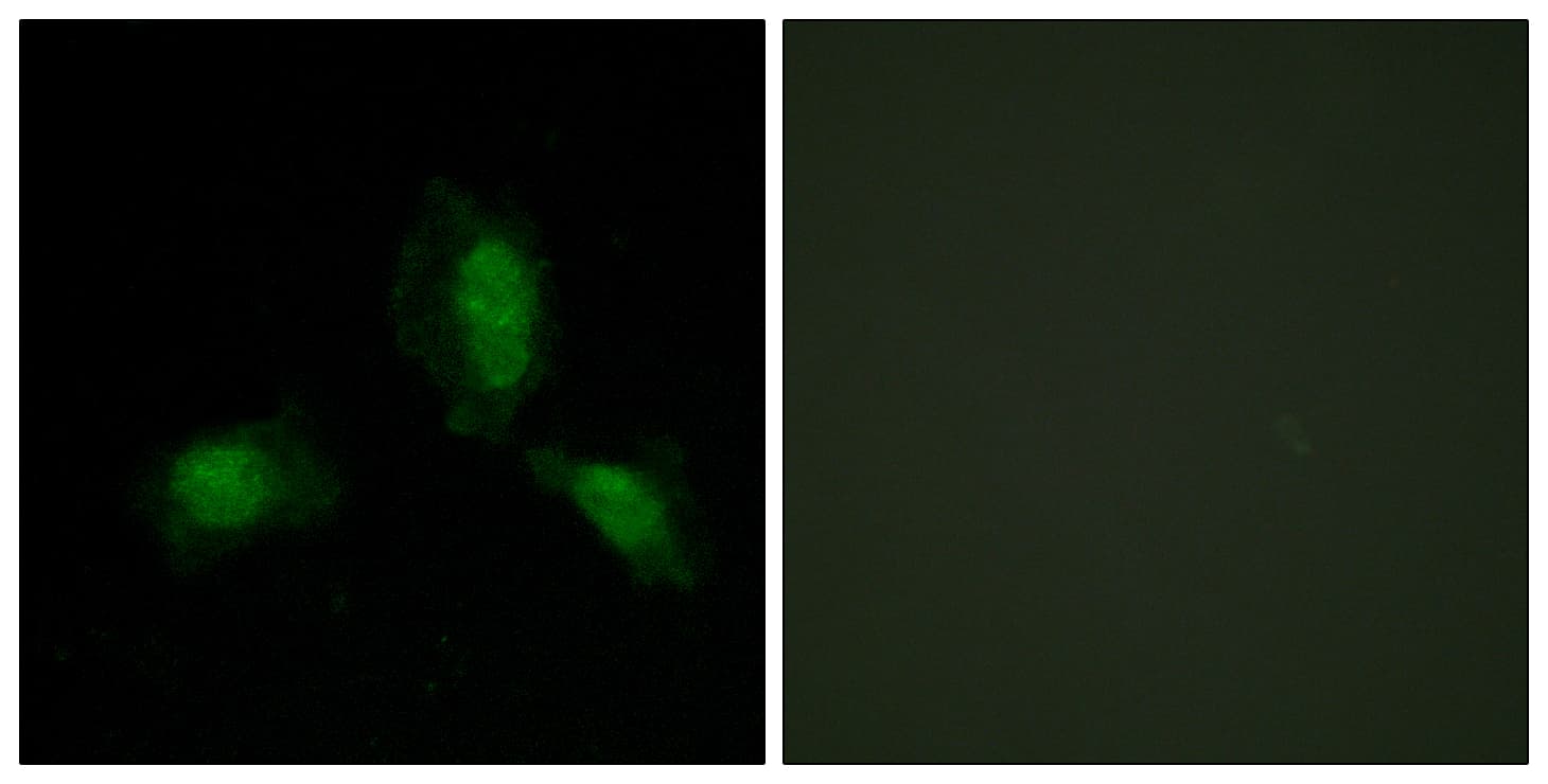 IRS1 Antibody (aa279-328)