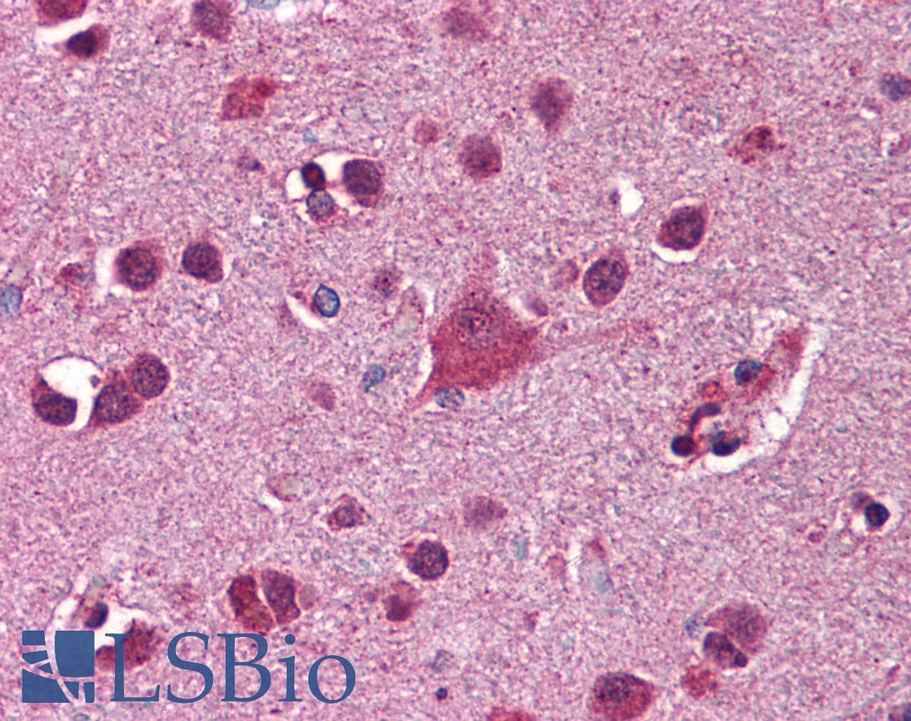 Polyclonal Rabbit anti-Human FKBP5 / FKBP51 Antibody (aa326-375, IHC, WB)