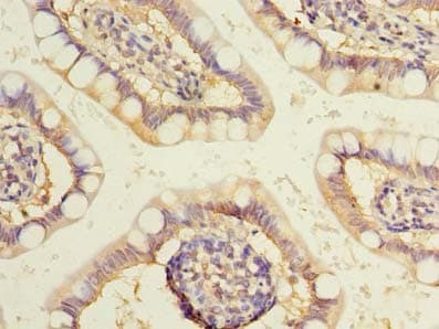 WDR49 Antibody