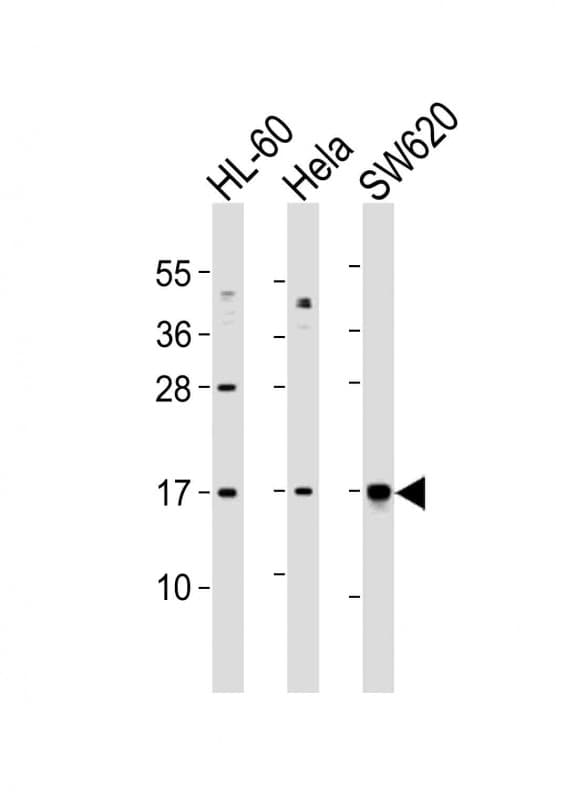 Polyclonal Rabbit anti-Human UBE2N / UBC13 Antibody (aa41-74, WB)