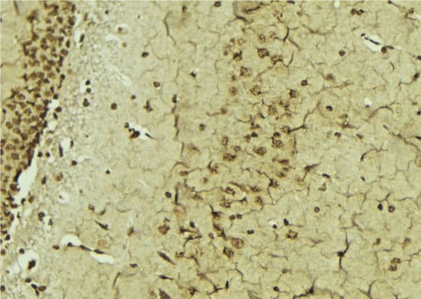 ERCC3 / XPB Antibody