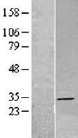 DHRS4 / PSCD Protein (Over-Expression Lysate Myc-DDK (Flag))