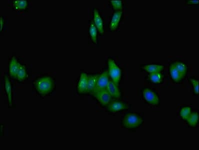 TRAIL-R3 / DCR1 Antibody