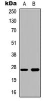 IHC-plus™ CTSZ / Cathepsin Z Antibody (Internal)