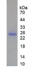 Human MMP13 Protein (Recombinant His)