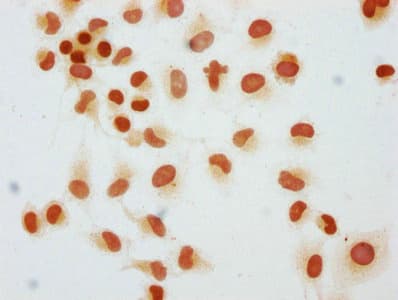Polyclonal Rabbit anti-Human HIST1H1C Antibody (WB)