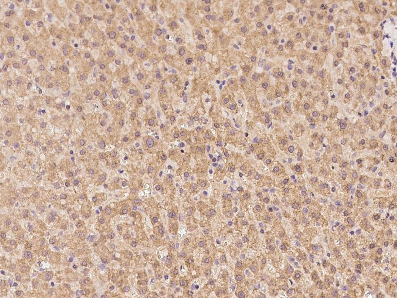 RIC3 Antibody