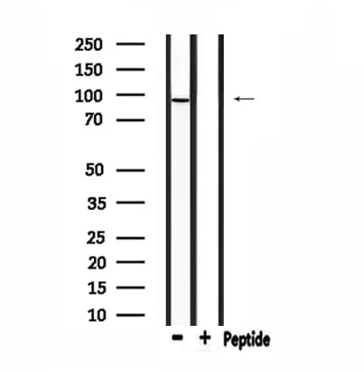 DMGDH Antibody