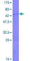 Human SCO1 Protein (Recombinant GST)