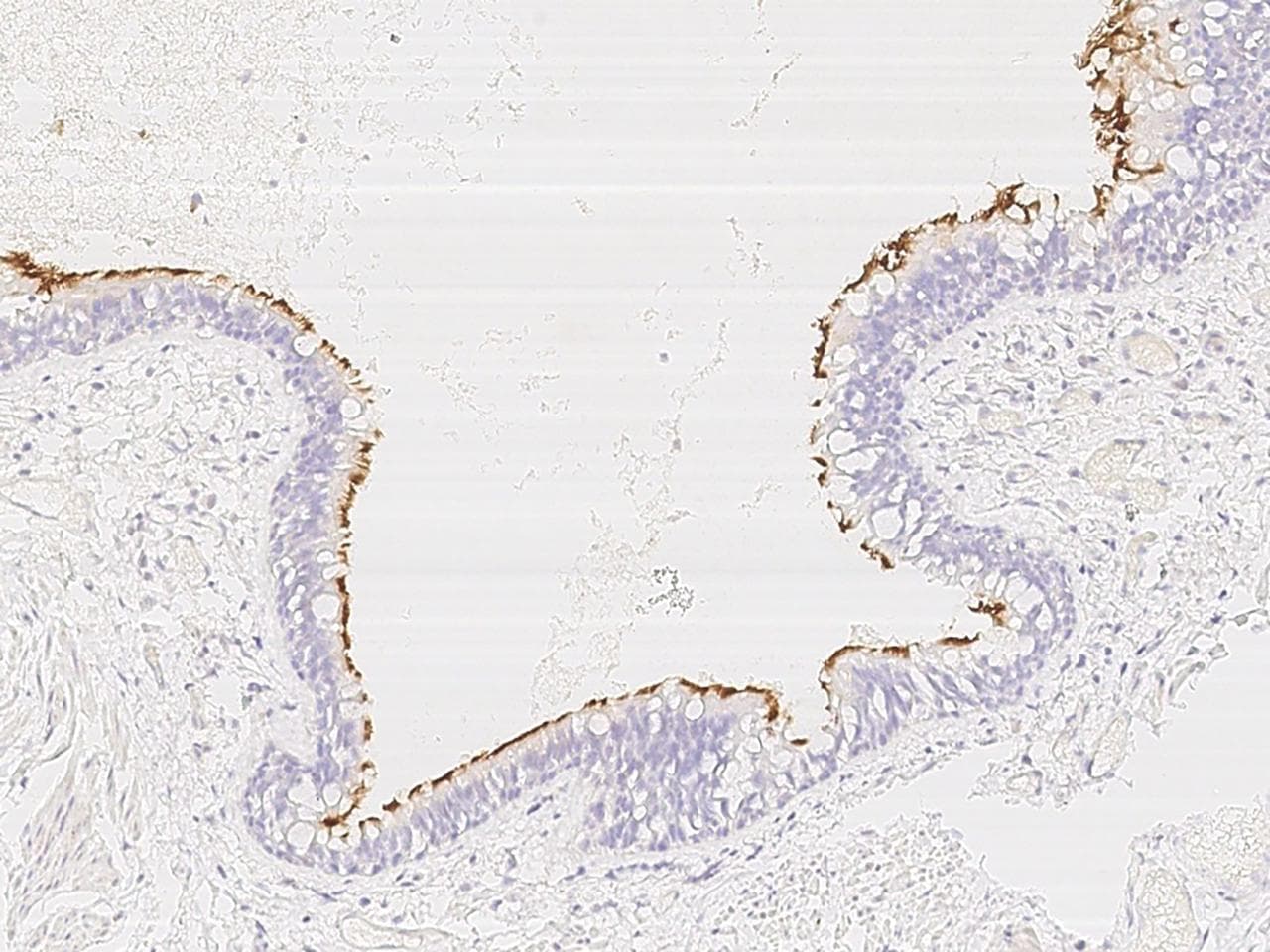 CCDC114 Antibody