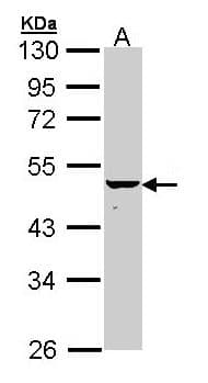 IHC-plus™ Polyclonal Rabbit anti-Human KRT34 / Keratin 34 / KRTHA4 Antibody (aa1-303, IHC, IF, WB)