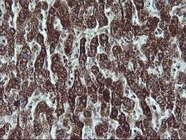 NDUFB9 Antibody (clone OTI3A1)