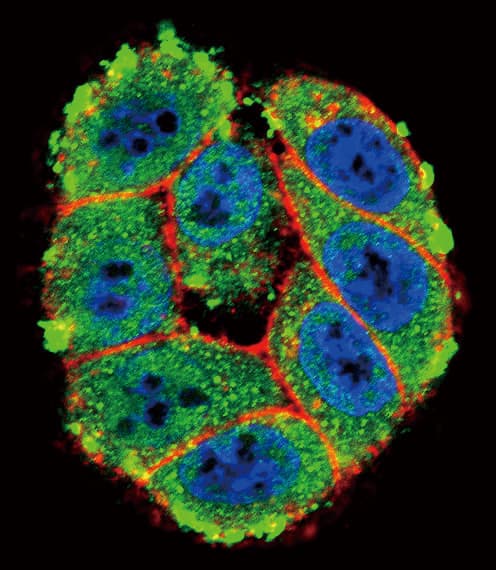PRKCA / PKC-Alpha Antibody (aa299-329)