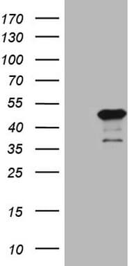 SETD8 / SET8 Antibody (clone OTI2B3)