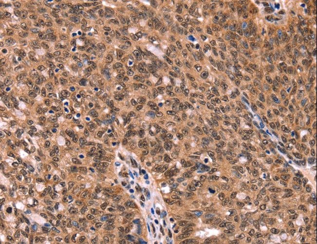 Polyclonal Rabbit anti-Human ESRRB / ERR Beta Antibody (IHC)