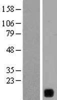 Human YIF1B Protein (Over-Expression Lysate Myc-DDK (Flag))