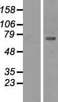 CAMK2B / CaMKII Beta Protein (Over-Expression Lysate Myc-DDK (Flag))