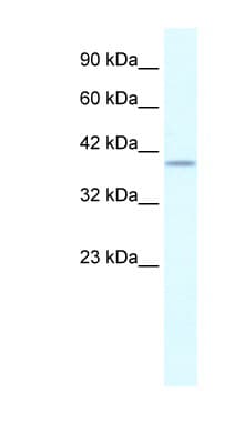 PHKG2 Antibody (N-Terminus)