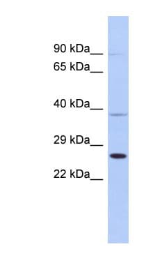 SARA2 / SAR1B Antibody (aa107-156)