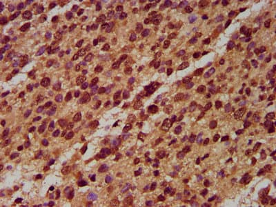 Polyclonal Rabbit anti-Human NALP6 / NLRP6 Antibody (IHC, IF)
