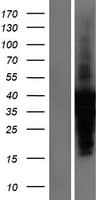 Human TNNI3 / Cardiac Troponin I Protein (Over-Expression Lysate Myc-DDK (Flag))