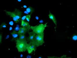DOK7 Antibody (clone OTI1F7)