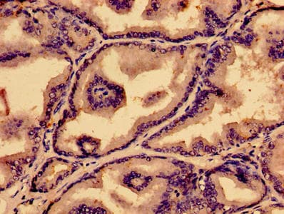 Polyclonal Rabbit anti-Human Prostaglandin D Synthase Antibody (aa23-190)