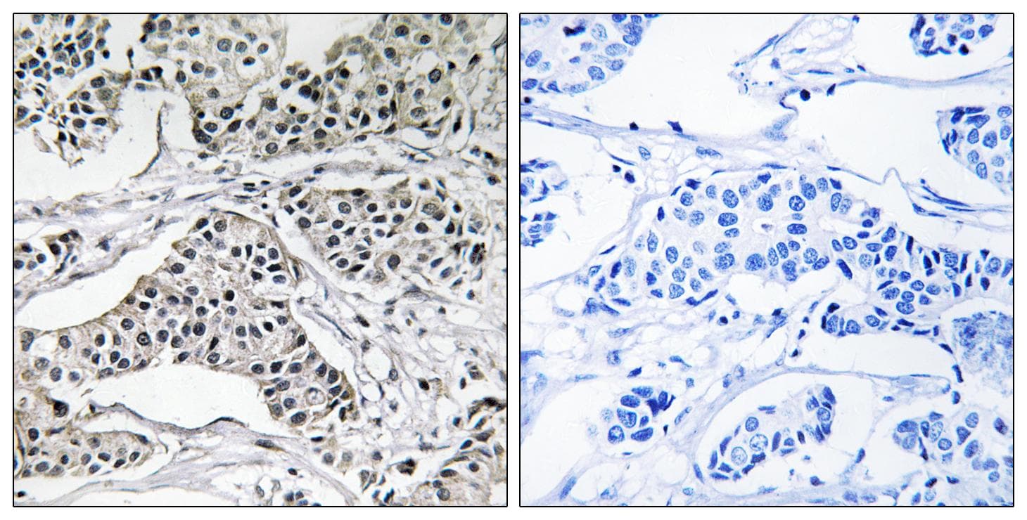 PLD3 / Phospholipase D3 Antibody