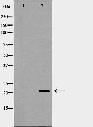 DHFR Antibody