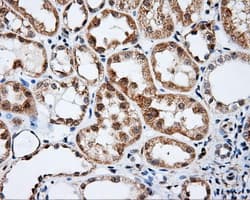 BTK Antibody (clone OTI12D4)