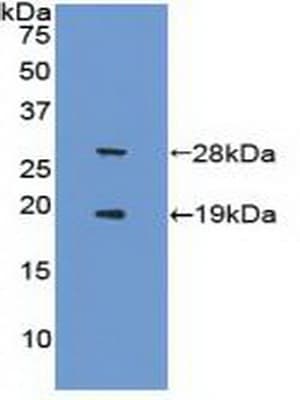 SIRT1 / Sirtuin 1 Antibody (aa244-498)